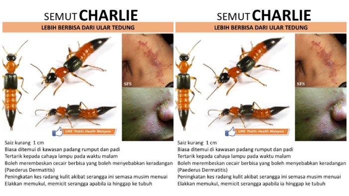 Viral di Facebook soal Bahaya Semut Charlie yang Beracun pada Kulit, Berikut Cara Penanganannya