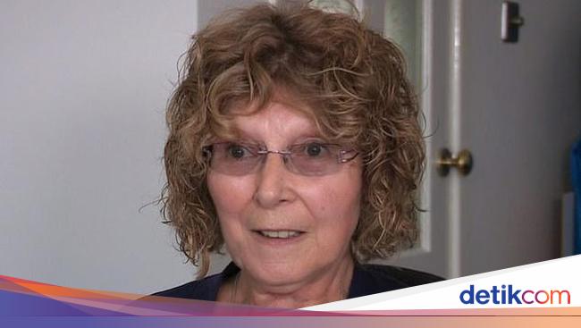 Cari Dokter Suntik Botox di Facebook, Wajah Wanita Ini Jadi Mirip Alien